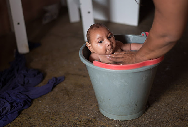 Zika masuk Malaysia: 5 perkara anda perlu tahu  SUMBER 