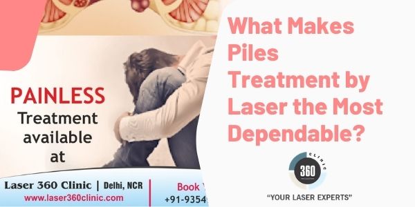 Piles Laser Treatment Cost In Delhi