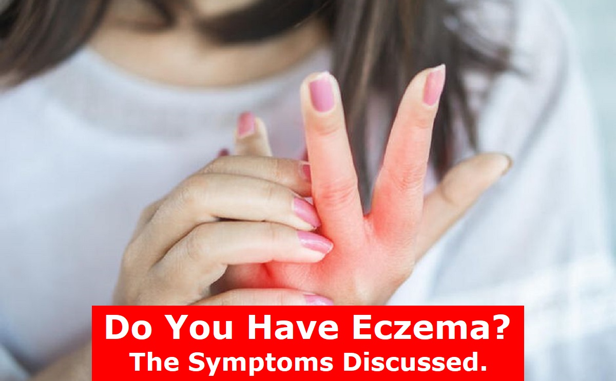 Do You Have Eczema? The Symptoms Discussed.