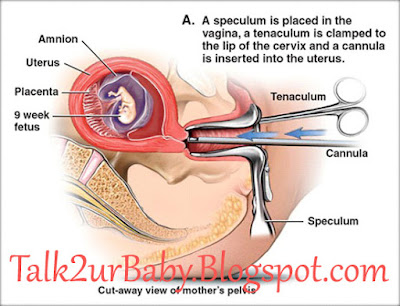 Sex after pregnancy