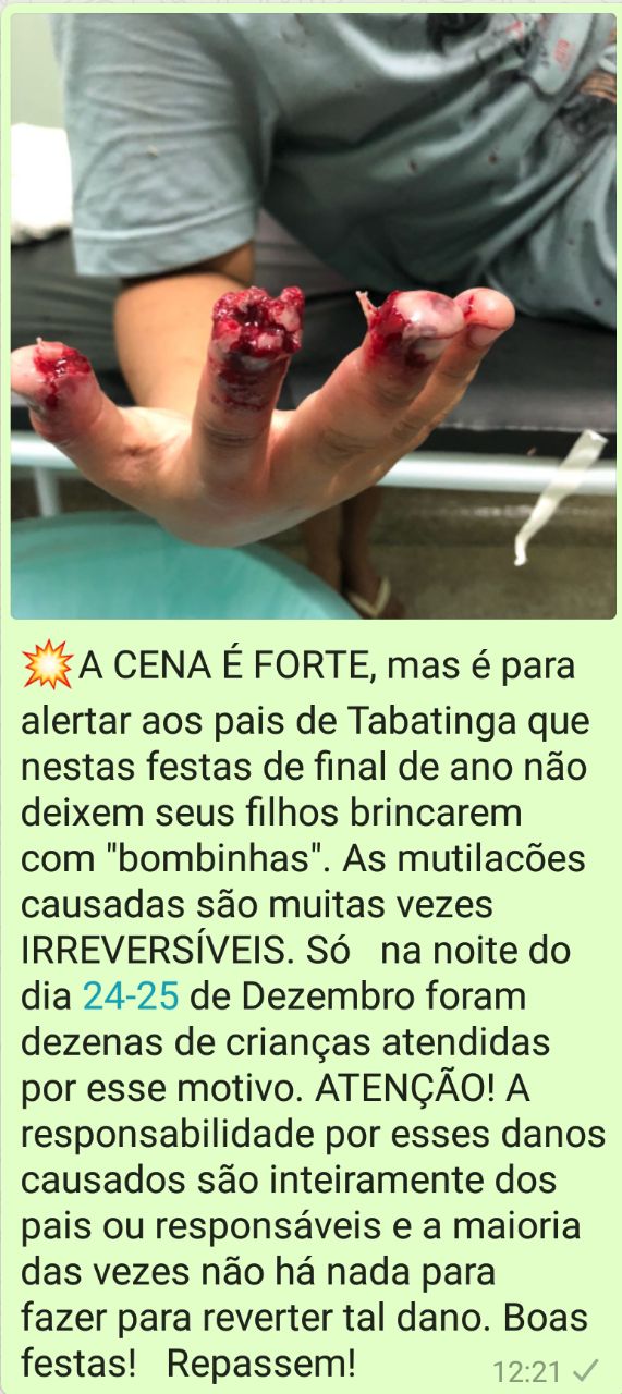 Alerta para as "bombinhas" nesse final de ano