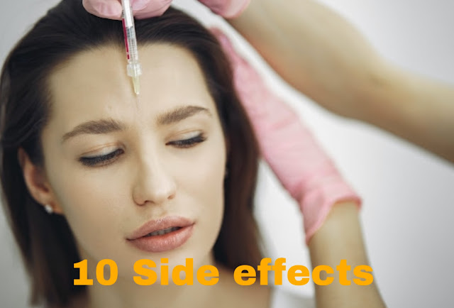 side effects of Botox