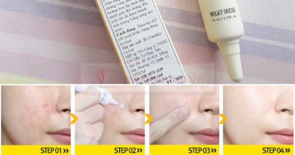 Kem trị mụn Milky Dress Talk Care Spot có tốt không