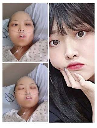 YouTuber Korea Kkuming Berjuang Lawan Kanker Mengucapkan Selamat Tinggal pada Penggemar dan Vlog terakhirnya