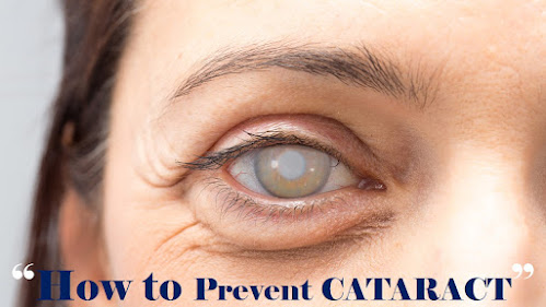 How to prevent Cataract, Foods for catract prevention
