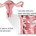 Cara Mengobati Keputihan Berjamur