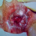 Obat Wasir Alami thumbnail