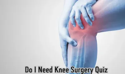 Do I Need Knee Surgery Quiz
