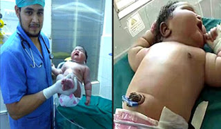  This newborn baby created it by birth, weight 6.82 kg