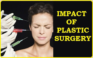  worst plastic surgery