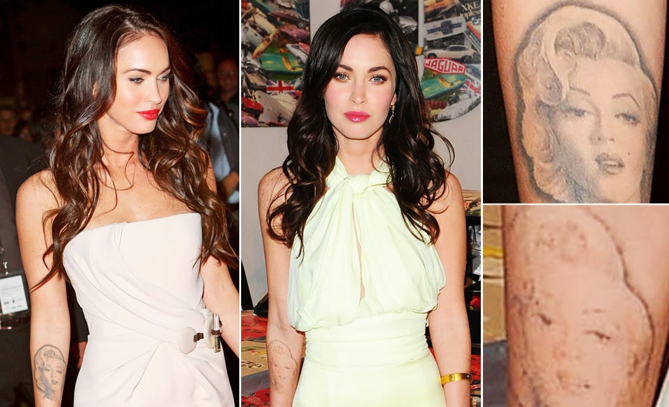 Megan Fox's on her way to painless tattoo removal