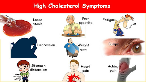 High Cholesterol symptons