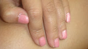 . skin is so sensitive that a scratch from my nails can cause me rashes.