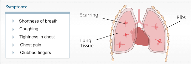 Handling Asbestos