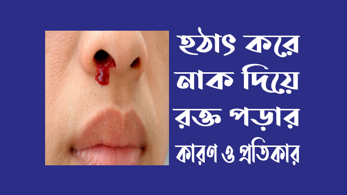 নাক দিয়ে রক্ত পড়ার কারণ