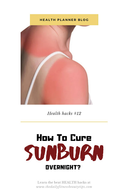 sunburn-natural-cream