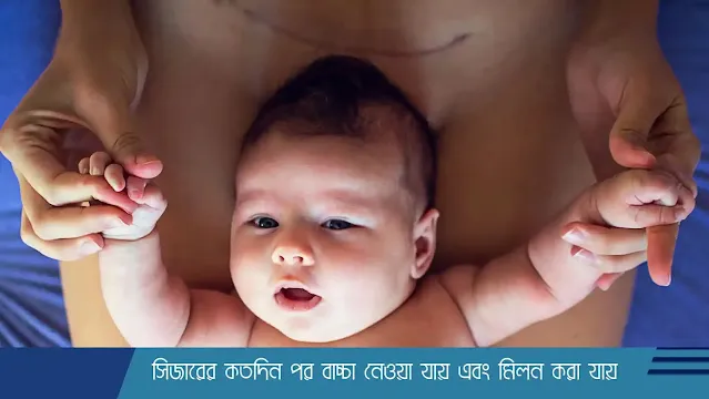 সিজারের কতদিন পর বাচ্চা নেওয়া যায়