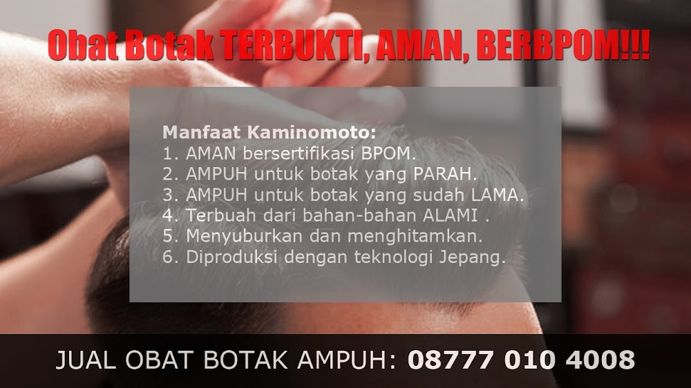 TOKO OBAT PENUMBUH RAMBUT DI SERANG<br/>Tanjung Balai Karimun<br/>