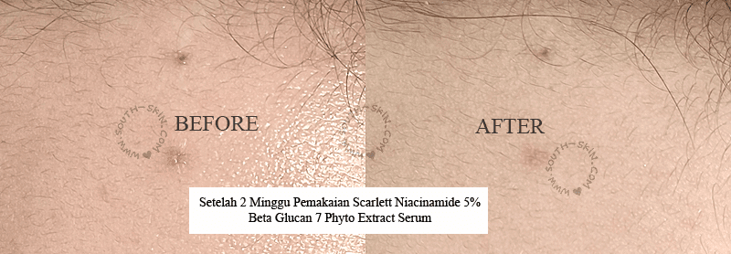 southskin-review-scarlett-niacinamide5%-beta-glucan-7phyto-extract-serum