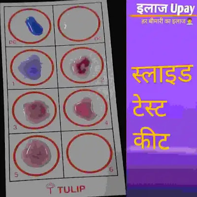 widal test in hindi , widal test positive means in hindi , typhi o positive means in hindi , typhi h positive means in hindi , widal test kit , typhoid test report , typhoid test ,