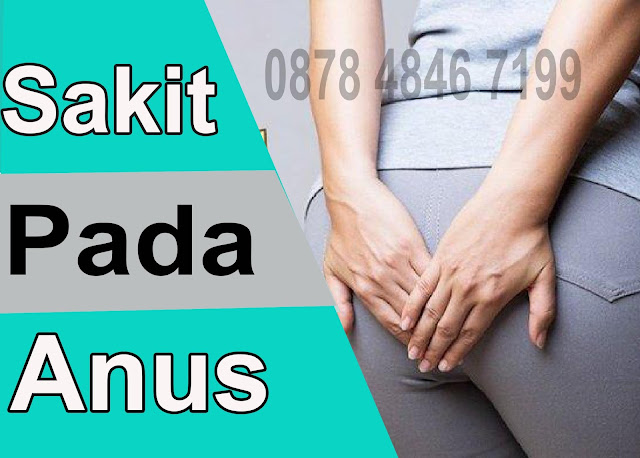 Obat Benjolan Wasir, Obat Benjolan Di Dubur, Obat Benjolan Ambeien