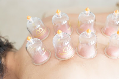 Vacuum Cupping & Massage Brisbane