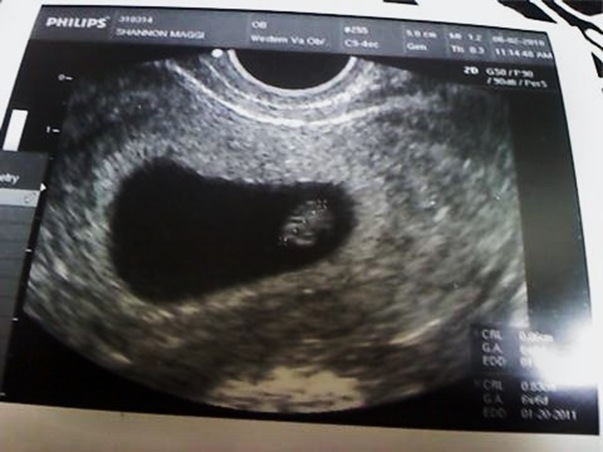 baby maggi