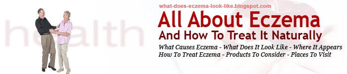 What Does Eczema Look Like & How To Treat It