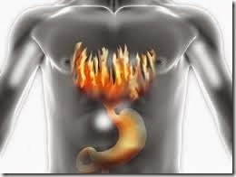 Baking soda to treat heartburn barrett esophagus or digestive upset