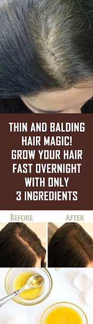 Thin and Balding Hair Magic! Grow Your Hair Fast Overnight With Only 3 Ingredients