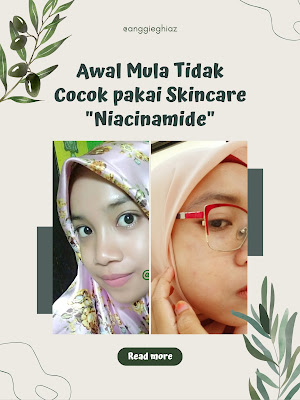 Sharing Awal Mula Tidak Cocok pakai Skincare Niacinamide