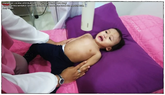 gambar bayi 1 tahun meneriwa rawatan sonotron di Sonotron Tawakal di Bandar Baru Bangi.