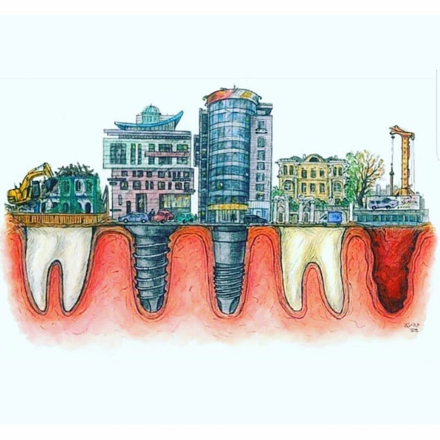Cosa devi sapere sui dentisti albanesi e sui lavori odontoiatrici in Albania?