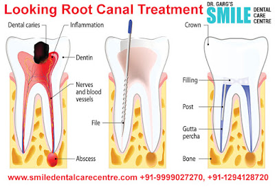 Best Dental Clinic in Faridabad