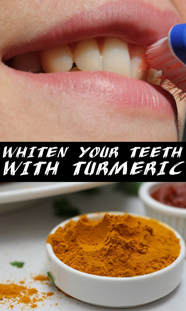 How To Whiten Your Teeth With Turmeric