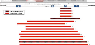 Incidence of the 22q11.2 deletion in a large cohort of miscarriage samples.