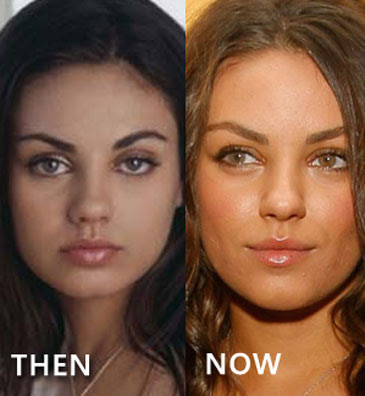  Mila Kunis to way in on the issue of plastic 