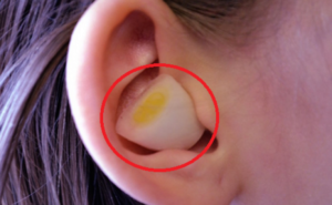  Εσείς ξέρατε τι θα συμβεί αν βάλετε σκόρδο στο αυτί σας;; ΟΧΙ δείτε  !!!