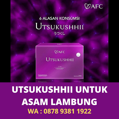 Obat Asam Lambung Paling Ampuh Utsukushhii