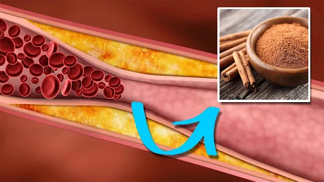 How to Lower Triglycerides and Bad Cholesterol Levels With One Single Ingredient