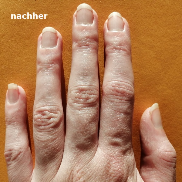 Nägel nachher