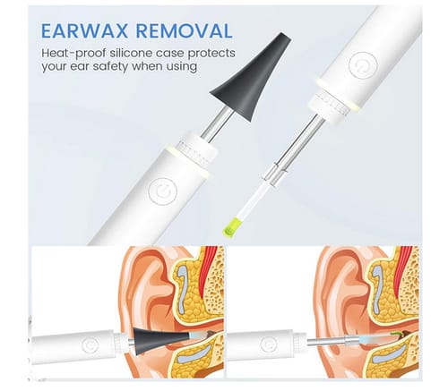 ScopeAround SA39A Ear Wax Removal with Camera