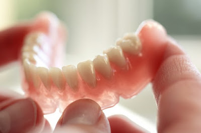 Các kiểu làm răng giả nguyên hàm