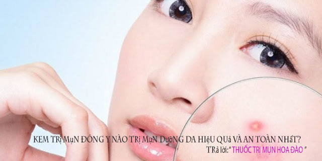 Kem trị mụn Đông Y nào trị mụn dưỡng da hiệu quả và an toàn nhất?