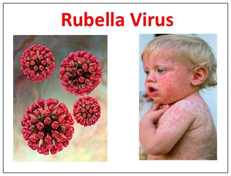 Pengobatan Herbal Mengatasi Virus Rubella