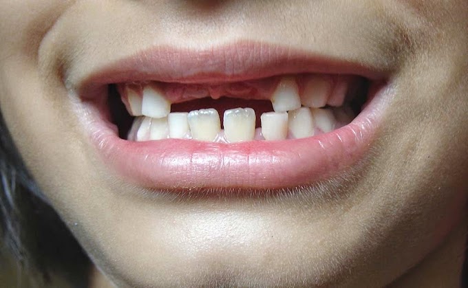 30 hitos de la Odontología: 5.000 años de historia