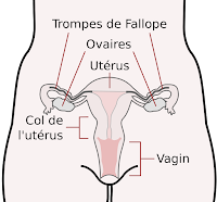 un risque de cancer de l'ovaire multiplié par deux