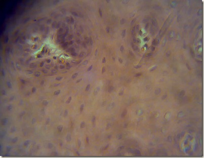 Compact bone high magnification 