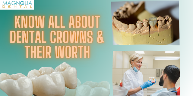 Dental Crowns in Waterdown
