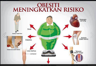 Nurul NurisSD2: FAKTA TENTANG OBESITI DI MALAYSIA